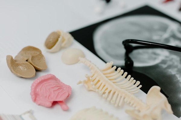 Comparaison de divers traitements de la migraine